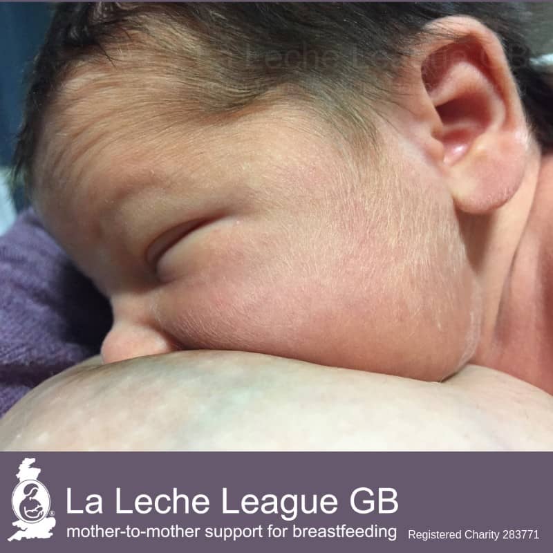 Engorged Breasts - avoiding and treating - La Leche League GB