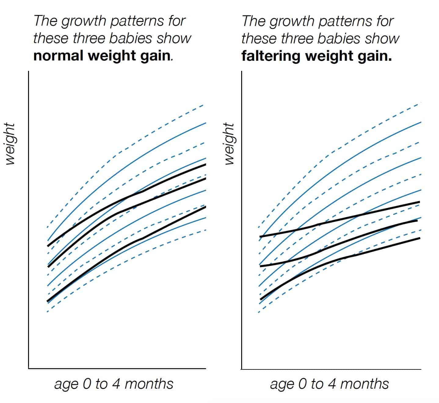 Growth Charts & Infant Weight Gain