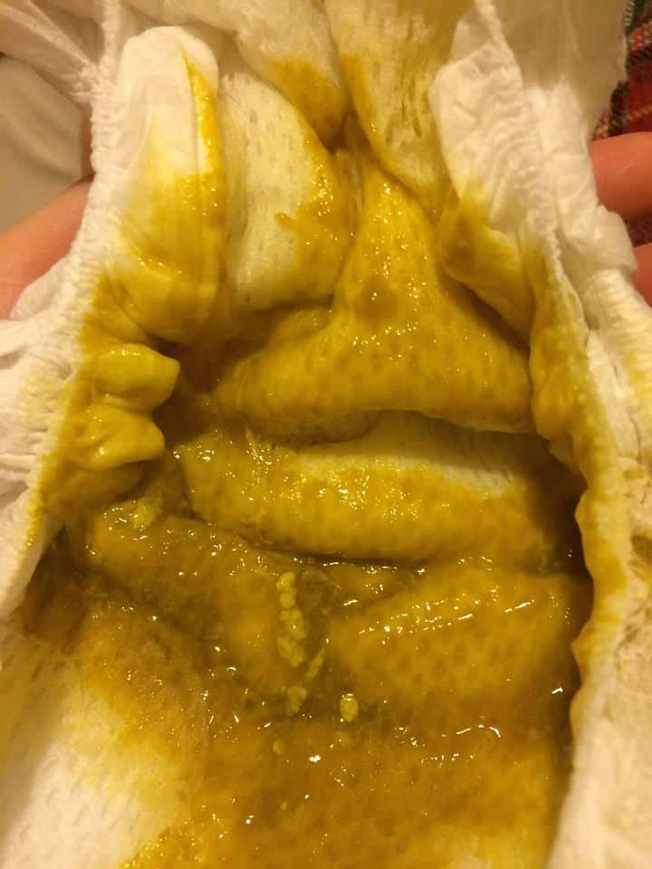 liquid poop yellow